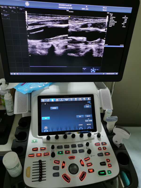   GE Vivid E95高端心血管彩超